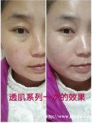 七老透肌亮肤产品效果怎样，安不安全，多少钱