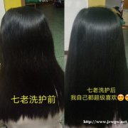 那个牌子洗发水可以改善女性头皮屑？