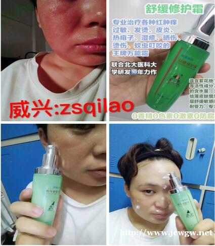 宝宝湿疹怎样快速止痒消除,七老舒缓霜 宝宝湿疹怎样快速止痒消除,七老舒缓霜