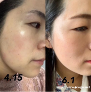 皮肤干燥暗黄有斑点用什么产品来调理皮肤