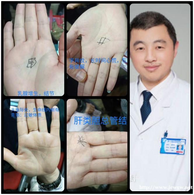 中医望诊疗法新四诊技术(手诊面诊培训班)姜军作 中医望诊疗法新四诊技术(手诊面诊培训班)姜军作