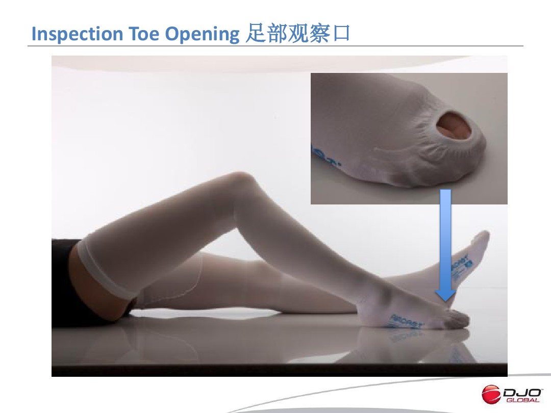 美国抗血栓弹力袜预防深部静脉血栓形成 美国抗血栓弹力袜预防深部静脉血栓形成