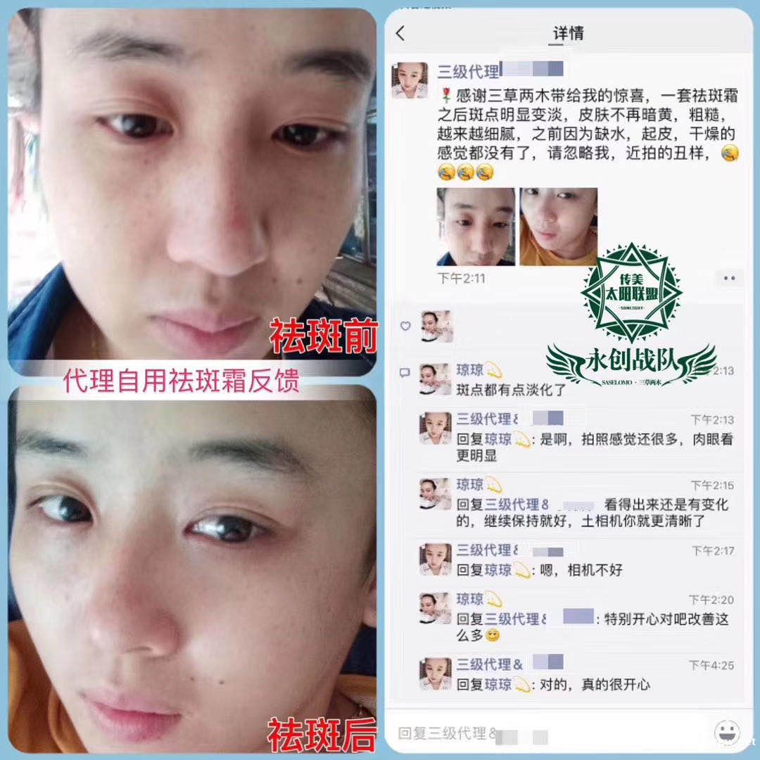 三草两木祛斑产品真的安全有效吗?会反弹吗? 三草两木祛斑产品真的安全有效吗?会反弹吗?