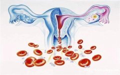 六里桥家政育儿分享：顺产恶露不尽，原因有哪些？