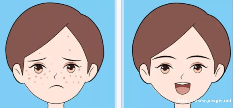 春天焕新激光美白闪耀发光 春天焕新激光美白闪耀发光