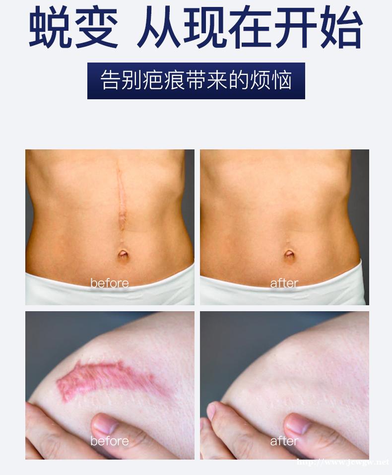 赛生玛雅巴可迪修护软膏的功效 赛生玛雅巴可迪修护软膏的功效