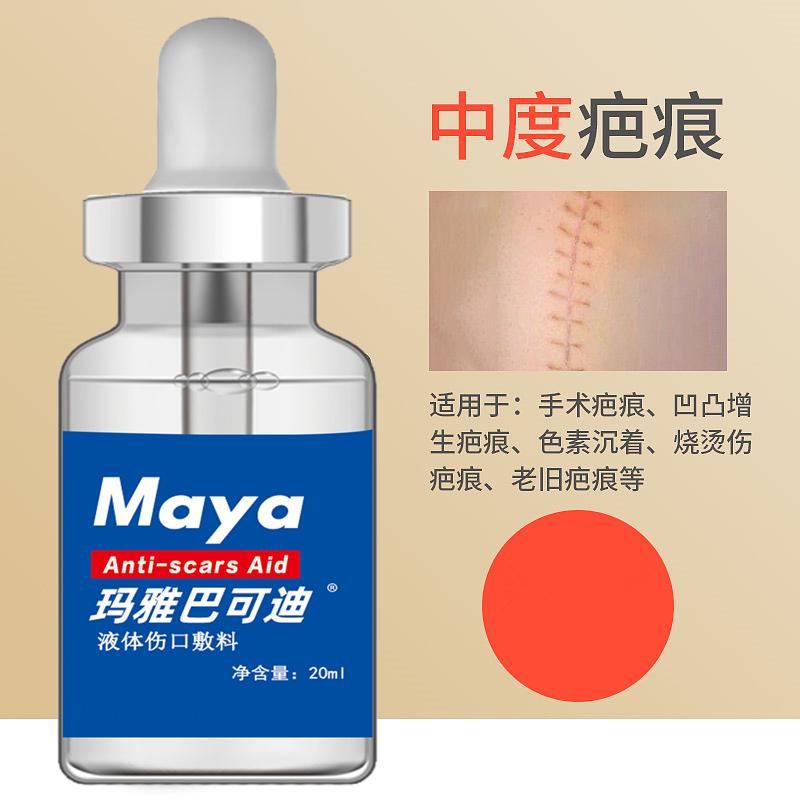 激光祛除疤痕的危害 –赛生玛雅巴可迪 激光祛除疤痕的危害 –赛生玛雅巴可迪