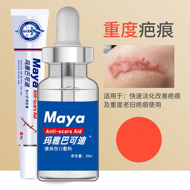 激光祛除疤痕的危害 –赛生玛雅巴可迪 激光祛除疤痕的危害 –赛生玛雅巴可迪